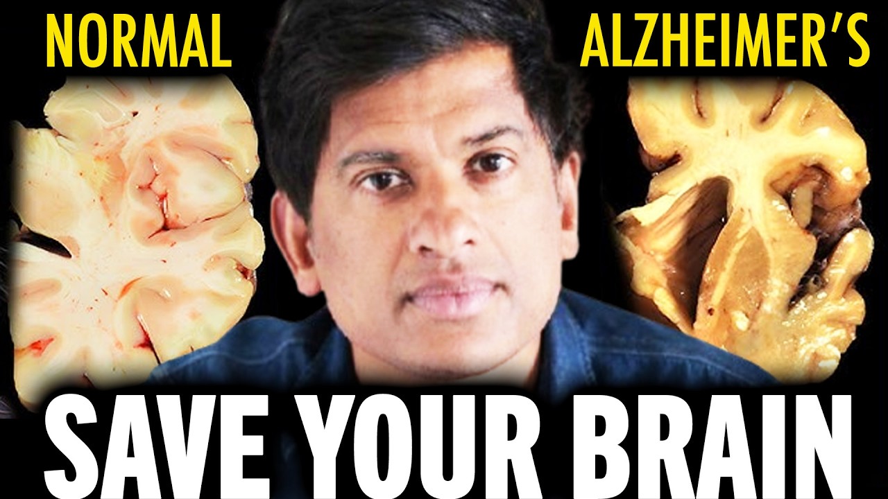 31 Minutes Today Could Save You 20+ Years of Alzheimer’s'